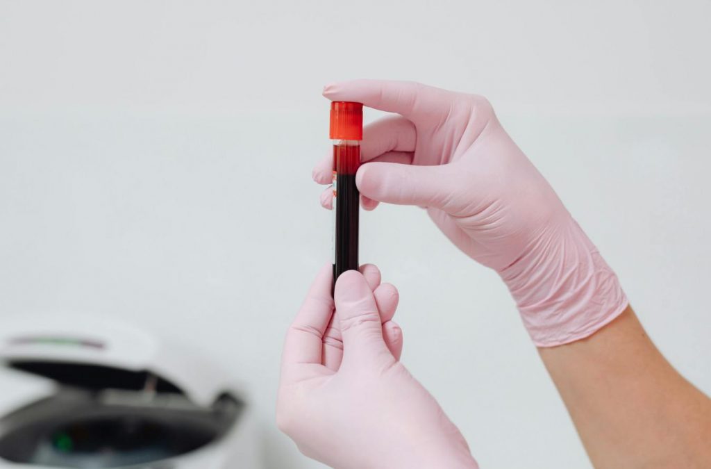 Blood testing